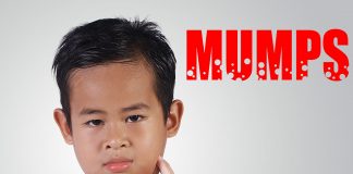 Mumps In Children