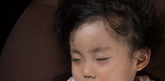 Heat Stroke in Babies Heat stroke in babies