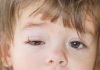 Conjunctivitis (Pink Eye) in Babies & Kids Conjunctivitis in Babies & Kids
