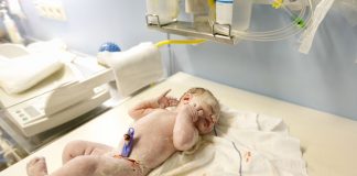 Macrosomia(Big Baby): A Labour complication MACROSOMIA