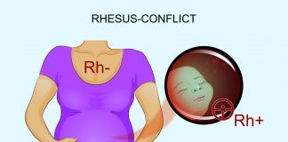 Pregnancy Testing: Rh Factor And Antibody Screen Illustration of Rh-conflict in a pregnant mother