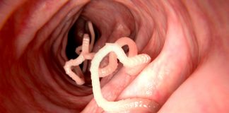 Worm Infection in Babies – Causes, Symptoms & Treatment WORMS IN BABIES