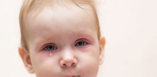 Eye Infections in Babies – Types, Symptoms and Treatment A baby with redness in the eyes crying due to discomfort