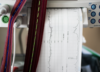 Foetal Monitoring Foetal Monitoring