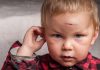 Head Injury in Children HEAD INJURY IN CHILDREN