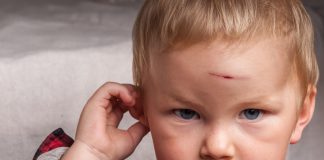 Head Injury in Children HEAD INJURY IN CHILDREN
