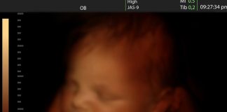 Do Babies Cry in the Womb? DO BABIES CRY IN THE WOMB?