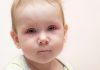 Bacterial Infection in Babies BACTERIAL INFECTION IN BABIES