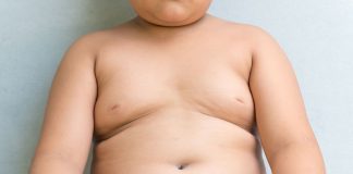 How to Lose Weight for Kids- 10 Easy Ways An overweight child