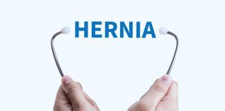 Umbilical Hernia After Pregnancy An Umbilical hernia