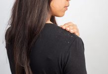 Dandruff During Pregnancy – Causes and Remedies