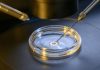 IVF: Side-Effects and Risks IVF