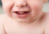 Teething in Toddler – Symptoms & Remedies Teething in Toddler - Symptoms & Remedies