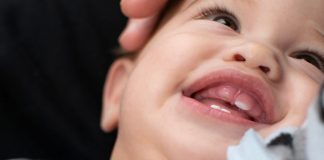 Crooked Teeth in Babies – Reasons and How to Deal Crooked teeth in babies