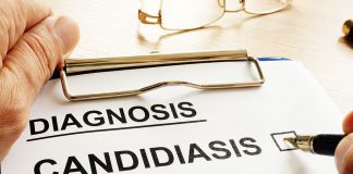 Can a Yeast Infection Affect Fertility and Your Chances of Conception Can a Yeast Infection Affect Fertility and Your Chances of Conception