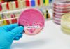 E. Coli Infection in Children E. coli Infection in Children